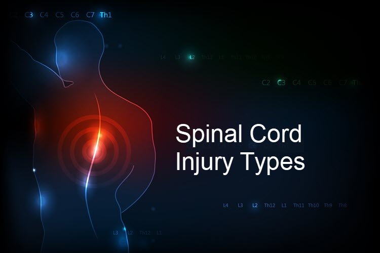 Spinal Cord Injury Types